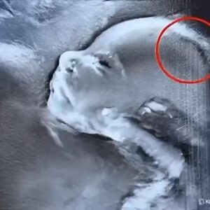 Doctors couldn’t believe what they saw during the ultrasound