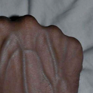 If your veins are visible in your hand, it is a signal