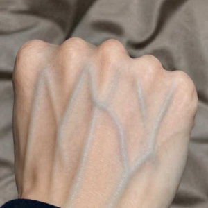 Visible Veins: What They Usually Mean (and When to Talk to a Doctor)