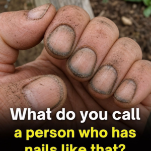 What Dirty Fingernails Really Reveal