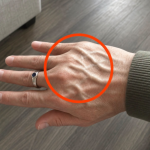 If you have visible veins it means you are…
