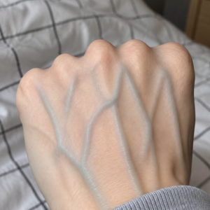 Visible Veins: What They Usually Mean (and When to Talk to a Doctor)