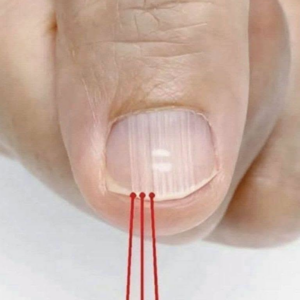 If you have these lines on your nails after the age of 40, it is a clear sign that…