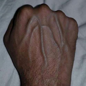 Restless Signals in Veins