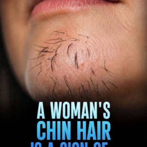 A Woman’s Chin Hair Could Be a Sign of More Than Just Aging, Experts Say